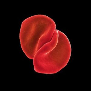 Peter Gabriel - Scratch My Back (2010)